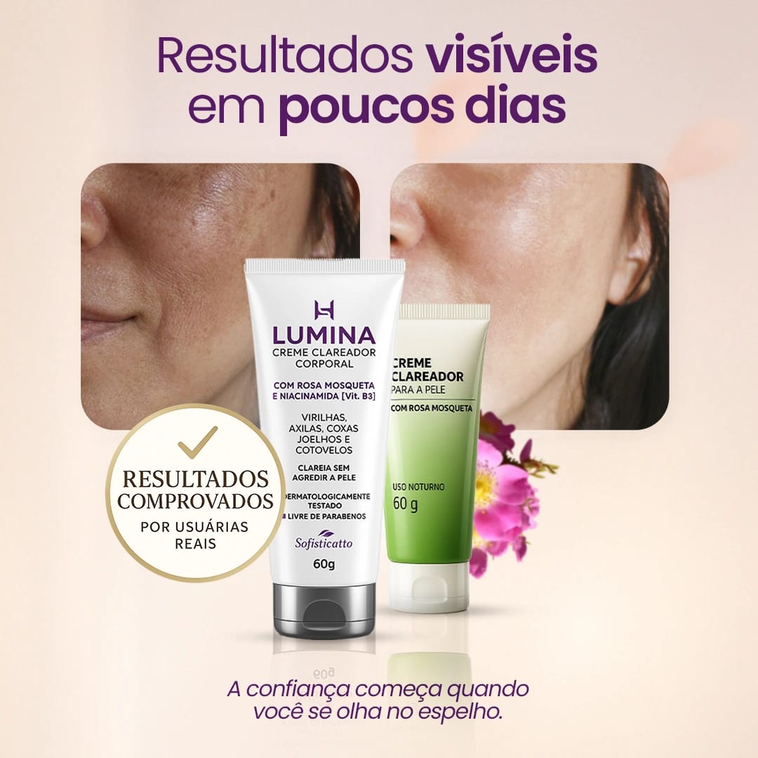 Resultados Visíveis do Lumina Creme Clareador